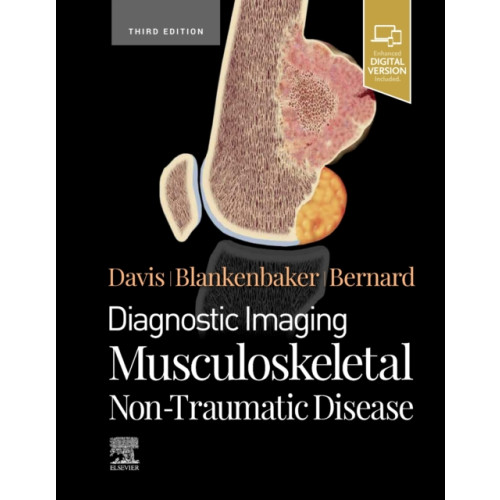 Elsevier - Health Sciences Division Diagnostic Imaging: Musculoskeletal Non-Traumatic Disease (inbunden, eng)