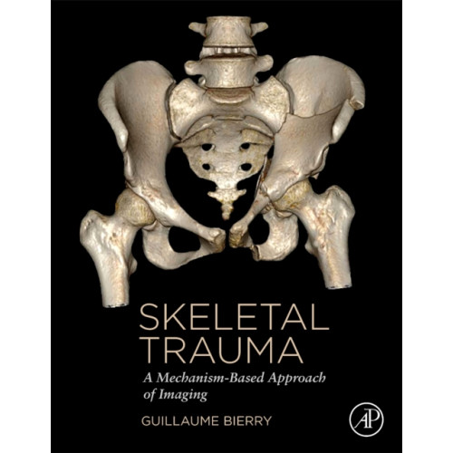 Elsevier Science & Technology Skeletal Trauma (inbunden, eng)