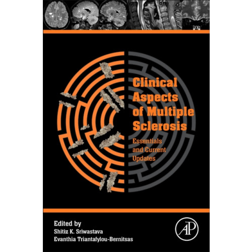 Elsevier Science & Technology Clinical Aspects of Multiple Sclerosis Essentials and Current Updates (häftad, eng)