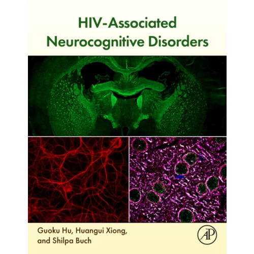 Elsevier Science & Technology HIV-Associated Neurocognitive Disorders (häftad, eng)