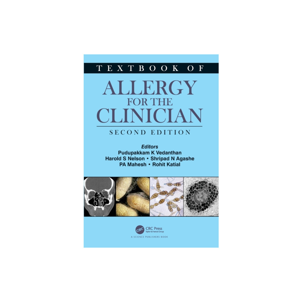 Produktbild för Textbook of Allergy for the Clinician (häftad, eng)
