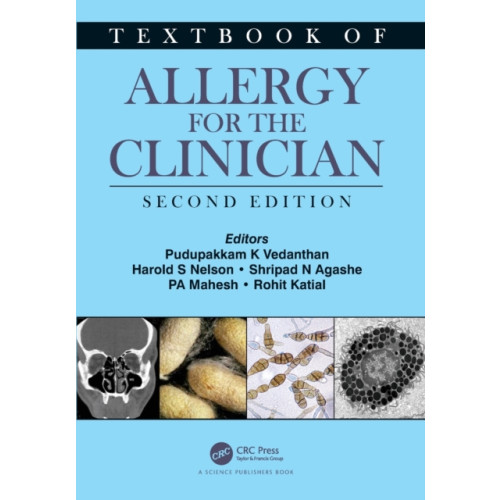 Taylor & francis ltd Textbook of Allergy for the Clinician (häftad, eng)