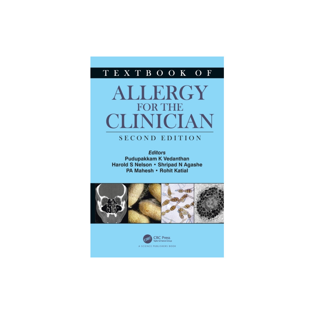 Produktbild för Textbook of Allergy for the Clinician (inbunden, eng)