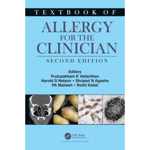 Taylor & francis ltd Textbook of Allergy for the Clinician (inbunden, eng)