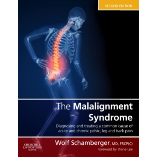 Elsevier Health Sciences The Malalignment Syndrome (inbunden, eng)