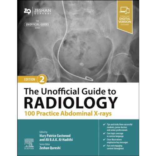 Elsevier Health Sciences The Unofficial Guide to Radiology: 100 Practice Abdominal X-rays (häftad, eng)