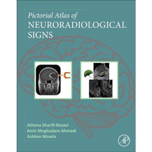 Elsevier Science Publishing Co Inc Pictorial Atlas of Neuroradiological Signs (häftad, eng)