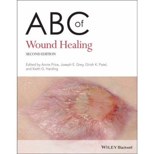 John Wiley & Sons Inc ABC of Wound Healing (häftad, eng)