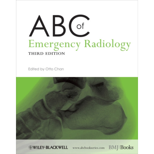 John Wiley & Sons Inc ABC of Emergency Radiology (häftad, eng)