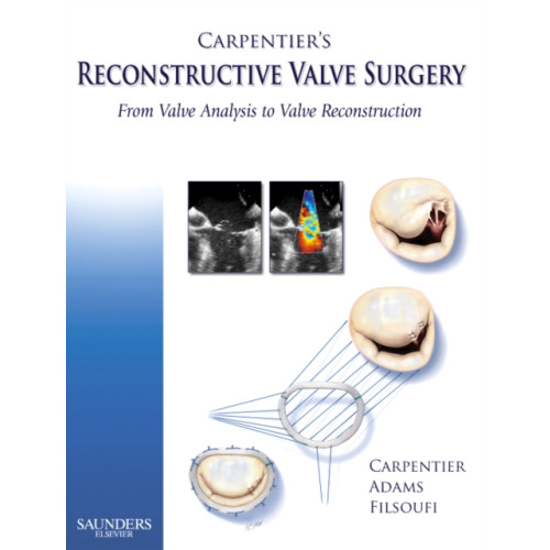 Elsevier Health Sciences Carpentier's Reconstructive Valve Surgery (inbunden, eng)