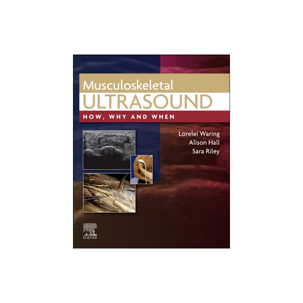 Produktbild för Musculoskeletal Ultrasound (inbunden, eng)