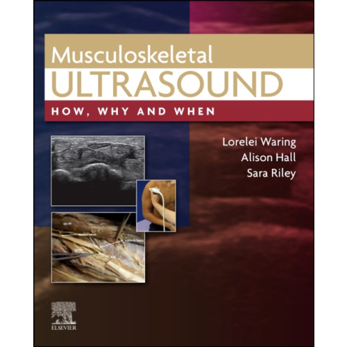 Elsevier Health Sciences Musculoskeletal Ultrasound (inbunden, eng)