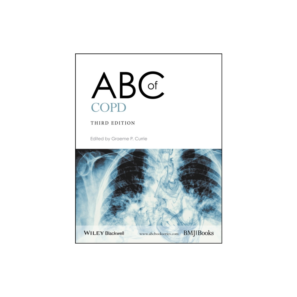 Produktbild för ABC of COPD (häftad, eng)