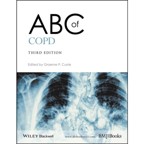 John Wiley And Sons Ltd ABC of COPD (häftad, eng)