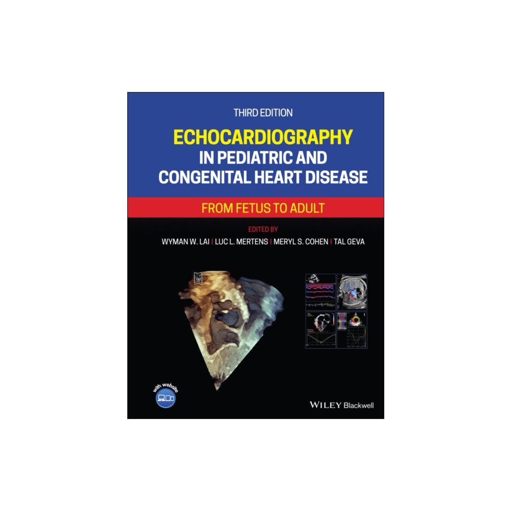 Produktbild för Echocardiography in Pediatric and Congenital Heart Disease (inbunden, eng)