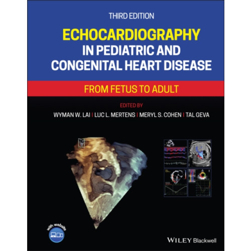John Wiley And Sons Ltd Echocardiography in Pediatric and Congenital Heart Disease (inbunden, eng)