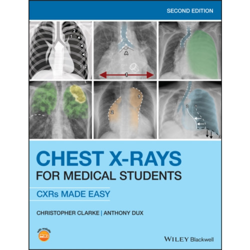 John Wiley And Sons Ltd Chest X-Rays for Medical Students (häftad, eng)