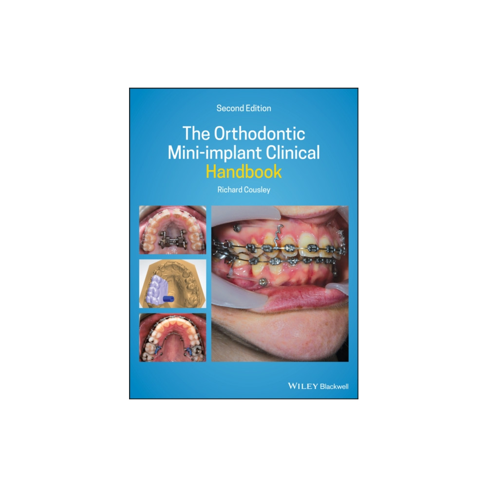 Produktbild för The Orthodontic Mini-implant Clinical Handbook (inbunden, eng)
