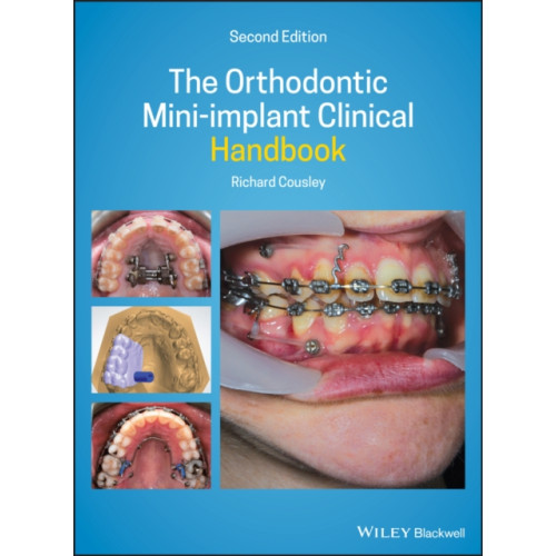 John Wiley And Sons Ltd The Orthodontic Mini-implant Clinical Handbook (inbunden, eng)