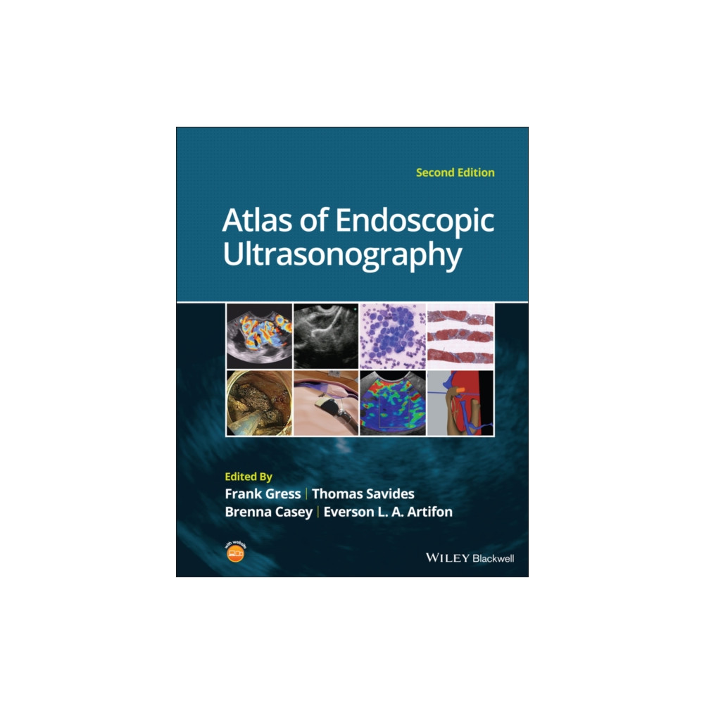 Produktbild för Atlas of Endoscopic Ultrasonography (inbunden, eng)