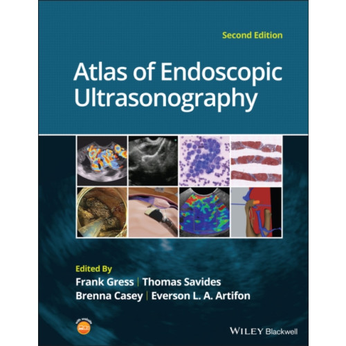 John Wiley And Sons Ltd Atlas of Endoscopic Ultrasonography (inbunden, eng)