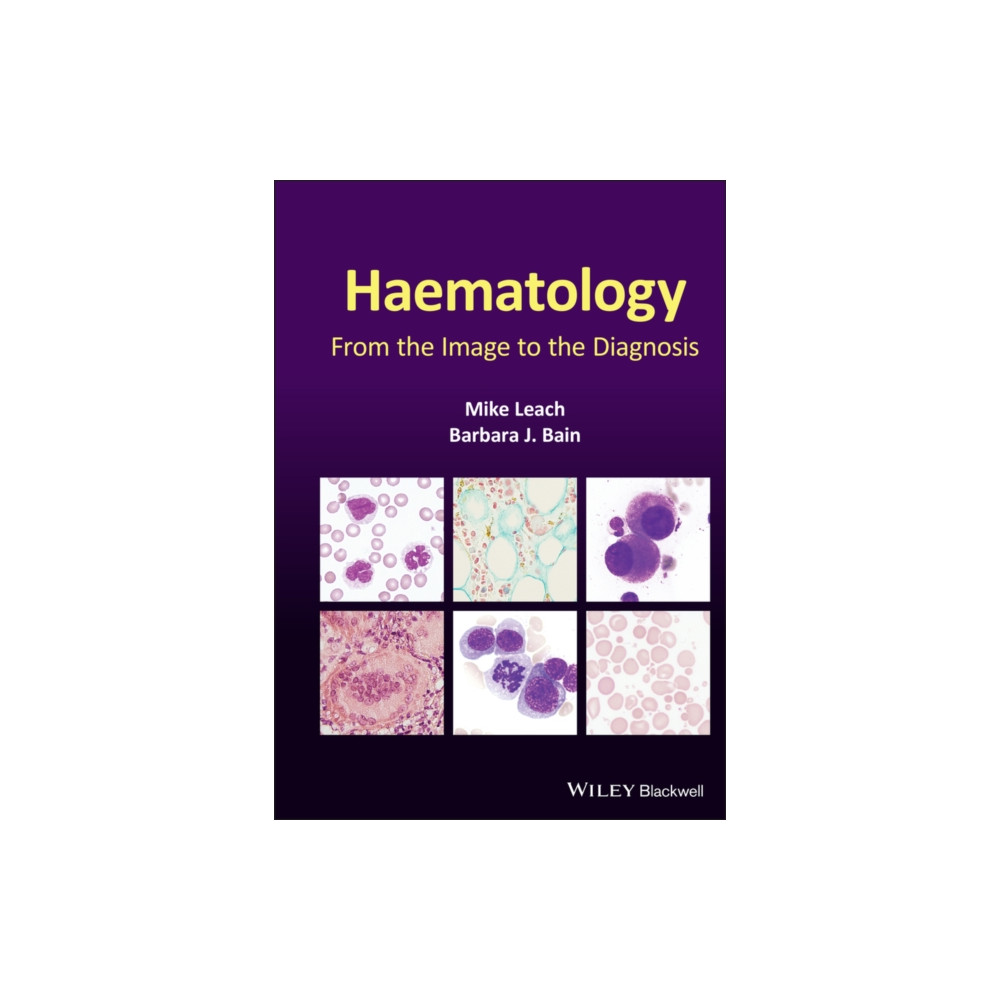 Produktbild för Haematology (inbunden, eng)