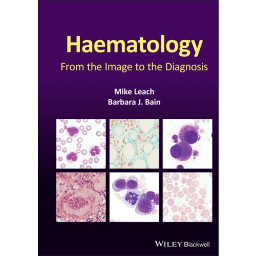 John Wiley And Sons Ltd Haematology (inbunden, eng)