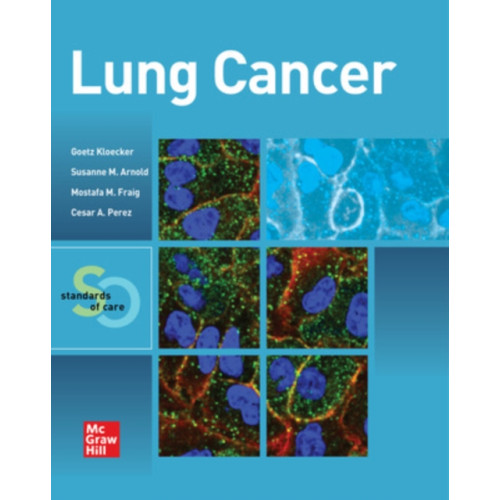 McGraw-Hill Education Lung Cancer:  Standards of Care (häftad, eng)