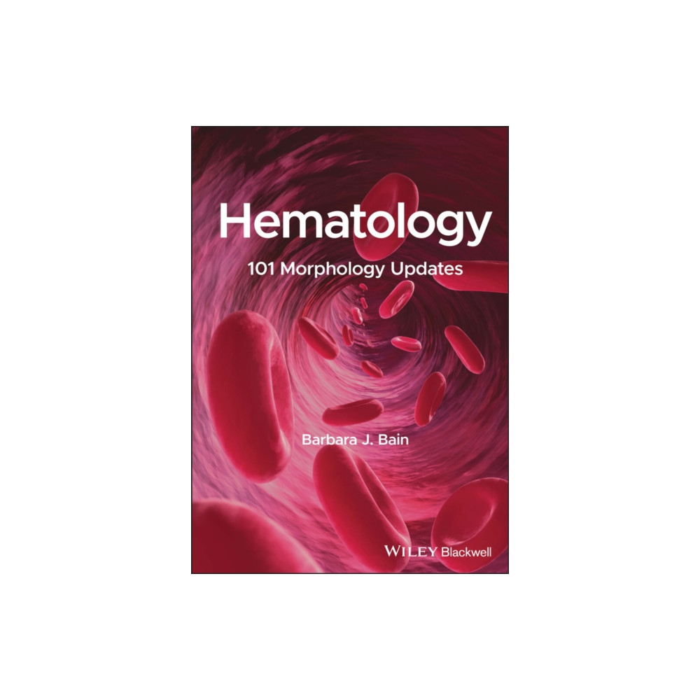 Produktbild för Hematology (häftad, eng)