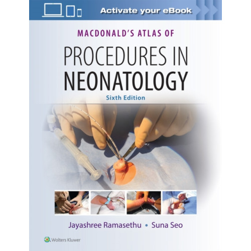 Lippincott Williams and Wilkins MacDonald's Atlas of Procedures in Neonatology (inbunden, eng)