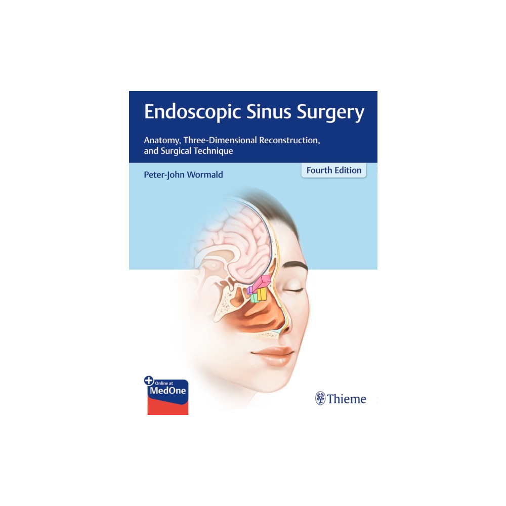 Produktbild för Endoscopic Sinus Surgery (inbunden, eng)