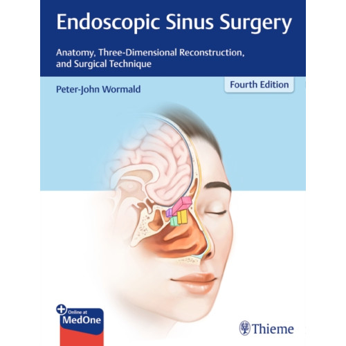 Thieme Medical Publishers Inc Endoscopic Sinus Surgery (inbunden, eng)