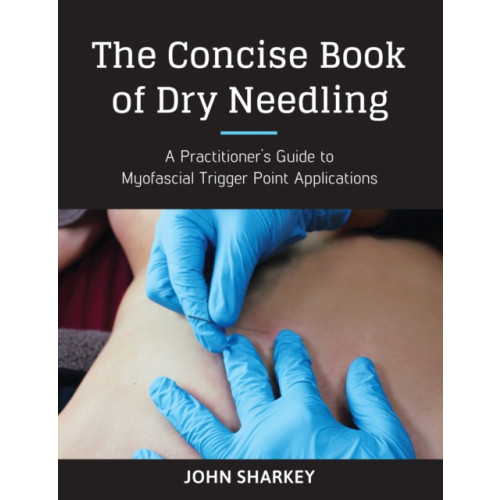 North Atlantic Books,U.S. The Concise Book of Dry Needling (häftad, eng)