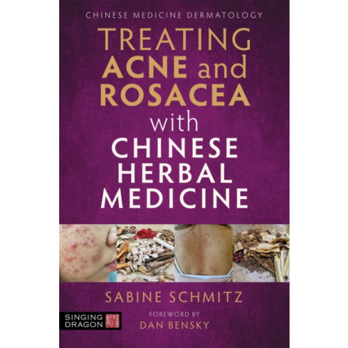 Jessica kingsley publishers Treating Acne and Rosacea with Chinese Herbal Medicine (häftad, eng)