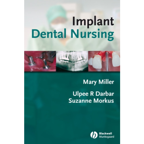 John Wiley And Sons Ltd Implant Dental Nursing (häftad, eng)