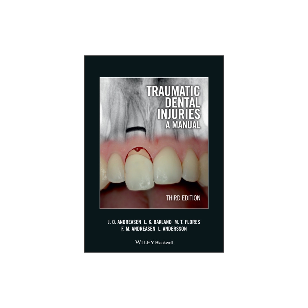 Produktbild för Traumatic Dental Injuries (häftad, eng)