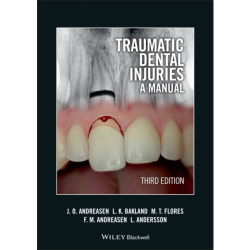 John Wiley And Sons Ltd Traumatic Dental Injuries (häftad, eng)
