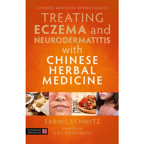 Jessica kingsley publishers Treating Eczema and Neurodermatitis with Chinese Herbal Medicine (häftad, eng)