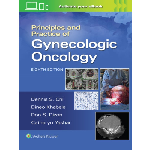 Wolters Kluwer Health Principles and Practice of Gynecologic Oncology (inbunden, eng)