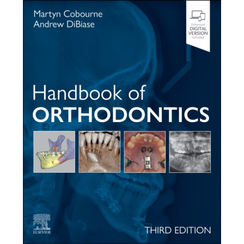 Elsevier - Health Sciences Division Handbook of Orthodontics (häftad, eng)