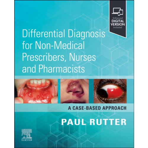 Elsevier Health Sciences Differential Diagnosis for Non-medical Prescribers, Nurses and Pharmacists: A Case-Based Approach (häftad, eng)