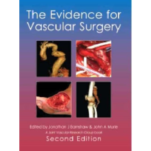 TFM Publishing Ltd The Evidence for Vascular Surgery; second edition (inbunden, eng)