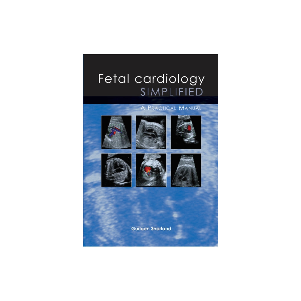 Produktbild för Fetal Cardiology Simplified (häftad, eng)