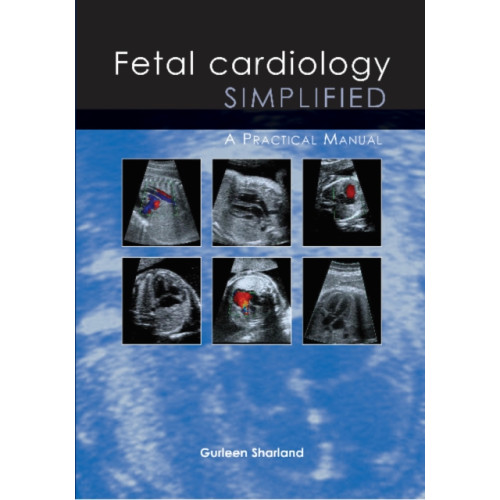 TFM Publishing Ltd Fetal Cardiology Simplified (häftad, eng)