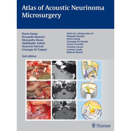 Thieme Publishing Group Atlas of Acoustic Neurinoma Microsurgery (inbunden, eng)