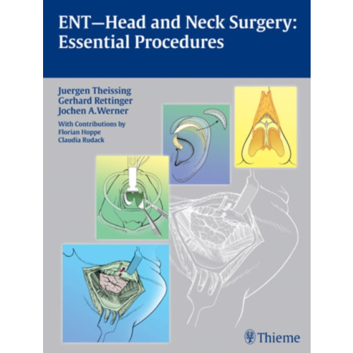 Thieme Publishing Group ENT Head and Neck Surgery: Essential Procedures (inbunden, eng)