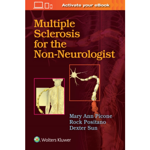 Wolters Kluwer Health Multiple Sclerosis for the Non-Neurologist (häftad, eng)