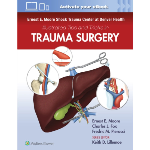 Wolters Kluwer Health Ernest E. Moore Shock Trauma Center at Denver Health Illustrated Tips and Tricks in Trauma Surgery (häftad, eng)