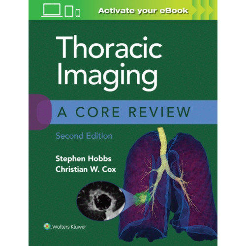 Wolters Kluwer Health Thoracic Imaging: A Core Review (häftad, eng)