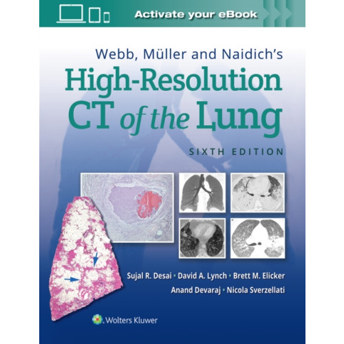 Wolters Kluwer Health Webb, Muller and Naidich's High-Resolution CT of the Lung (inbunden, eng)